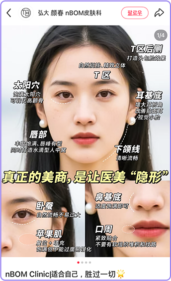 KOS 계정 사례 5